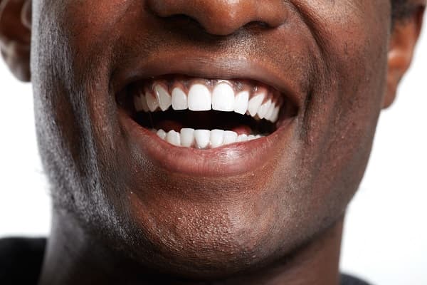 Cosmetic Dentistry