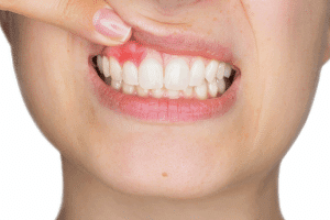 Periodontics