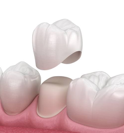 Restorative Dentistry