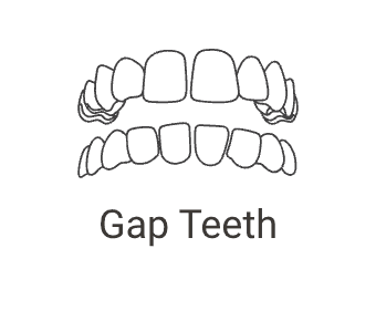 Gaps & Spacing