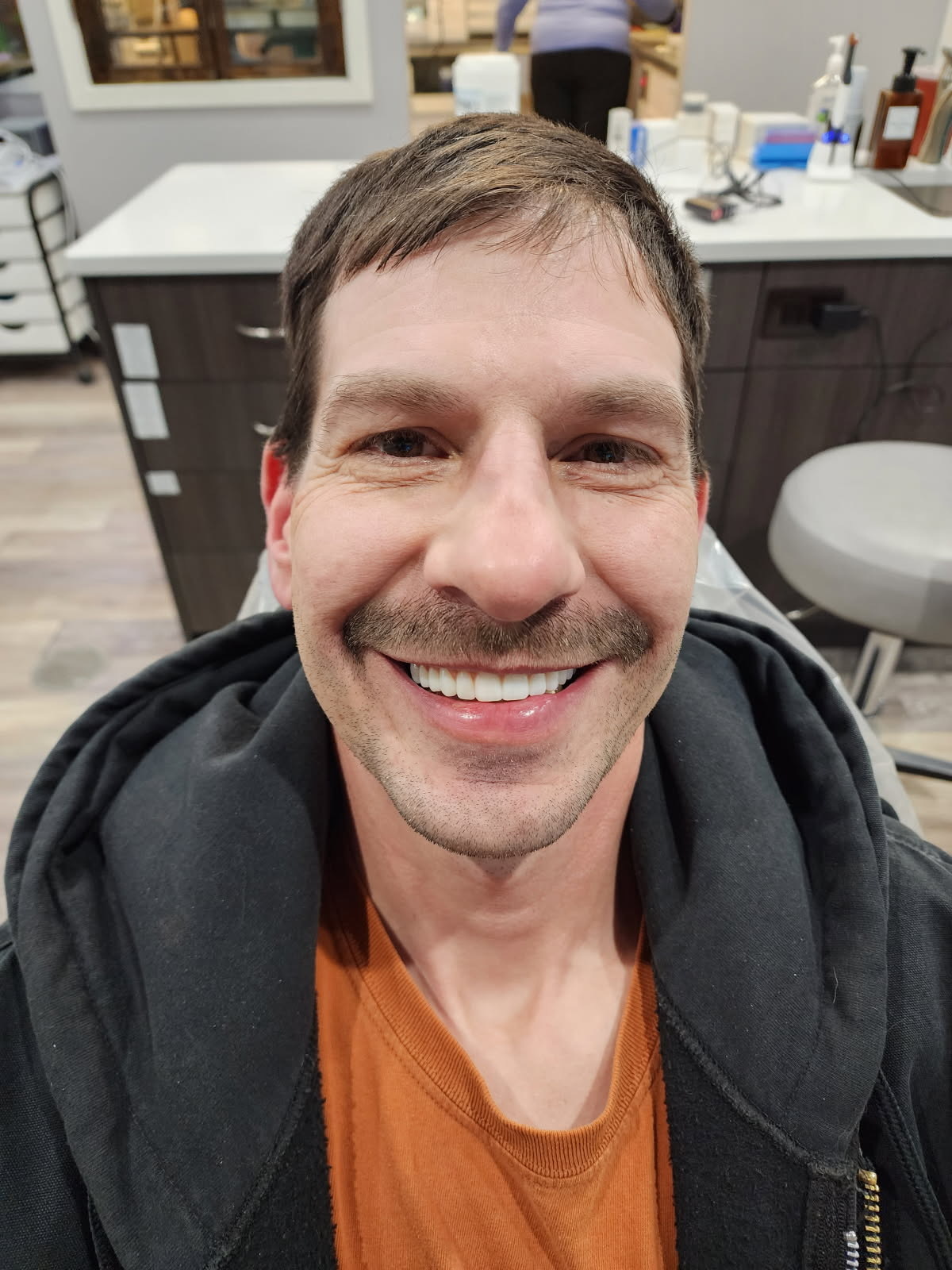 Before - Tooth stain removal